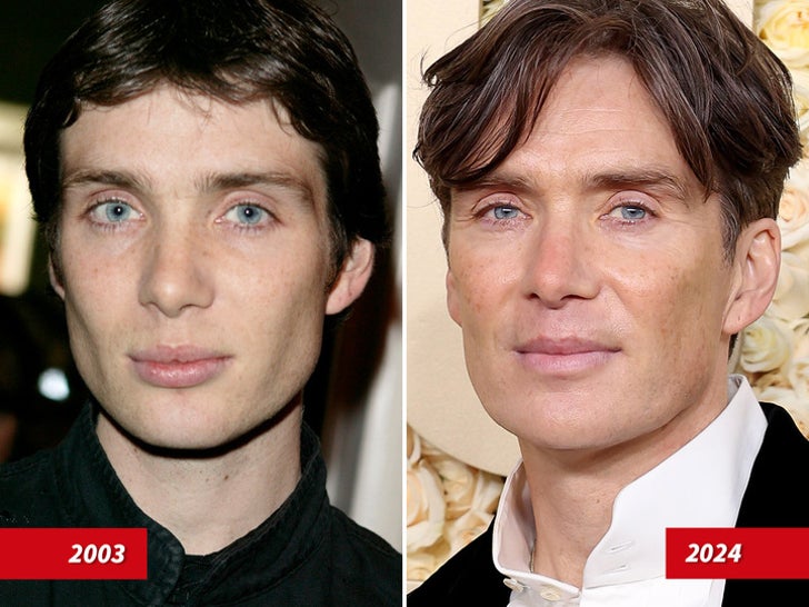 Cillian Murphy — Good Genes Or Good Docs?!