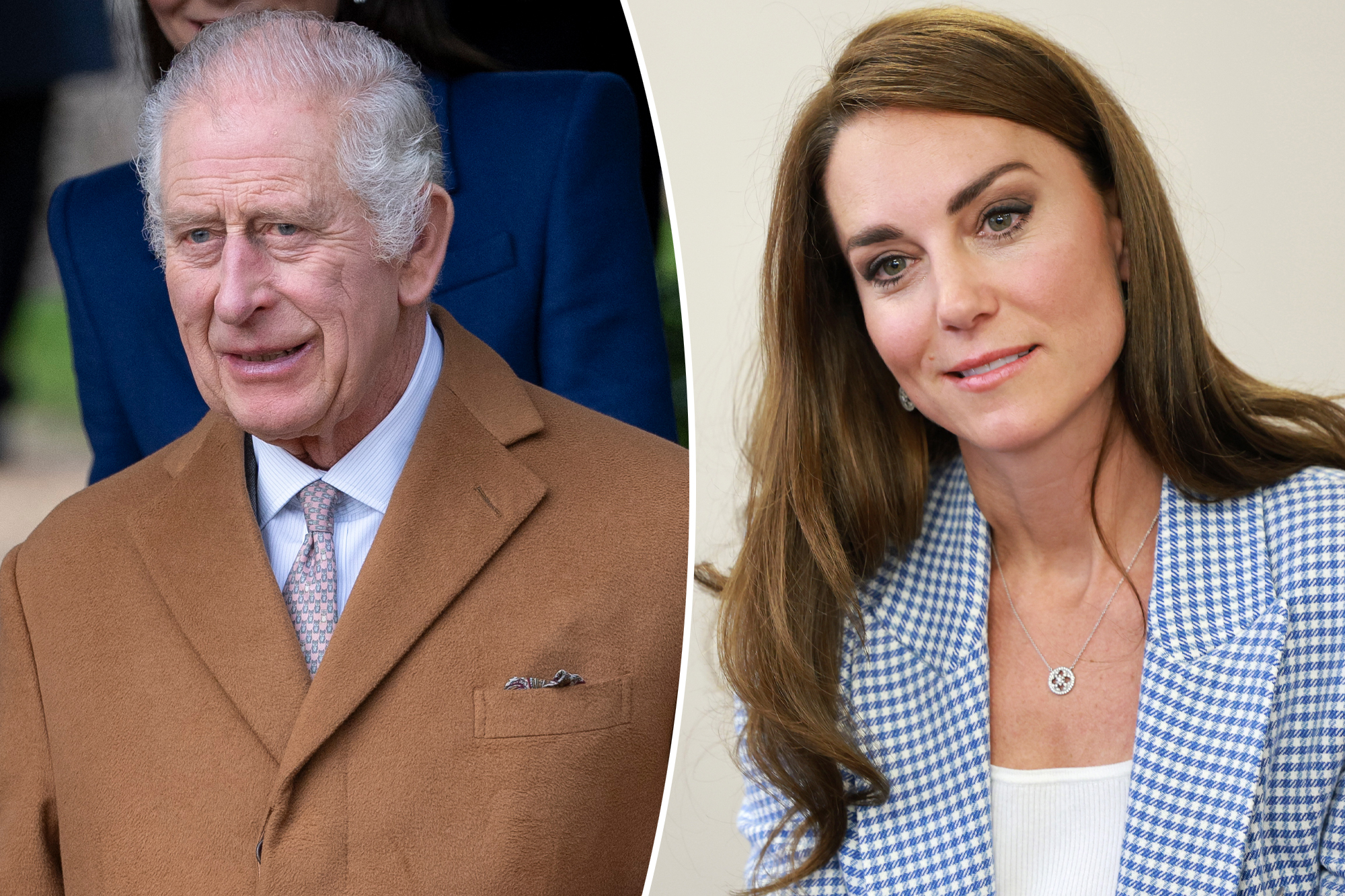 Why King Charles revealed his surgical procedure whereas Kate Middleton hid hers