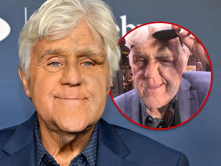 Jay Leno Wanting Higher After Nasty Fall Did Critical Injury to His Face