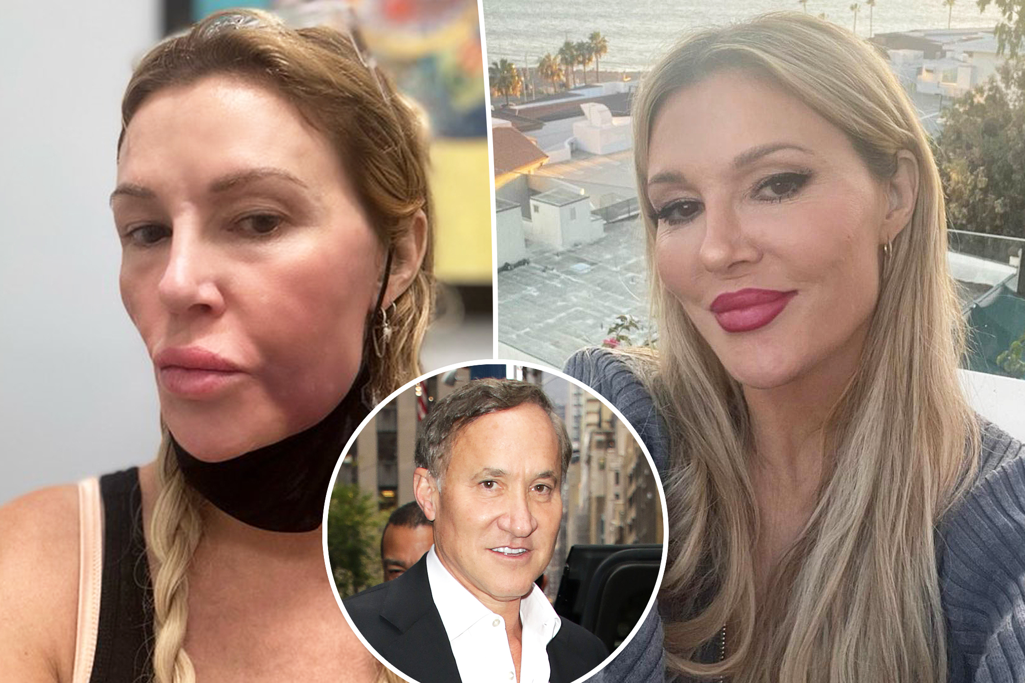 Brandi Glanville says she has ‘zero drama’ with Dr. Terry Dubrow