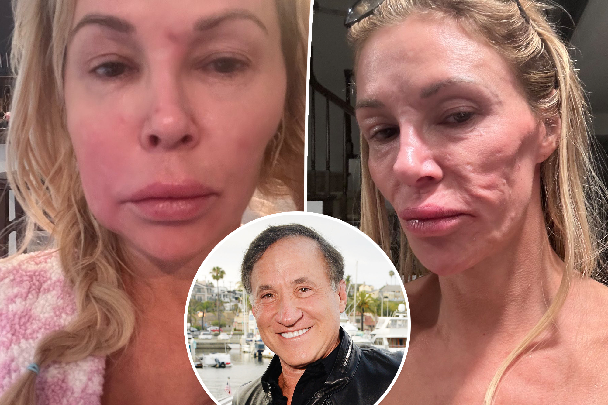 Dr. Terry Dubrow calls Brandi Glanville’s face a ‘ticking time bomb,’ provides assist