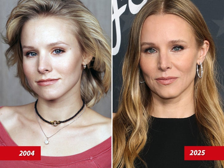 Kristen Bell — Good Genes or Good Docs?!